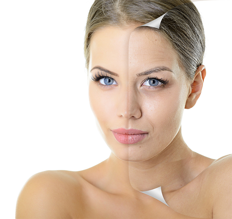 Anti Aging