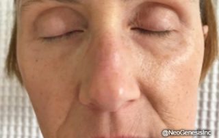 Before - Ageing Skin