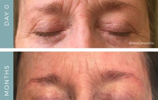 Before + After - Ageing Skin - Eyes