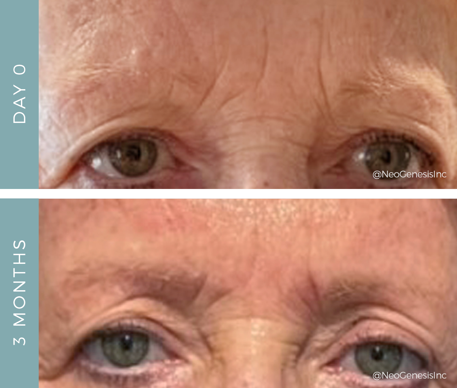 Before + After - Ageing Skin