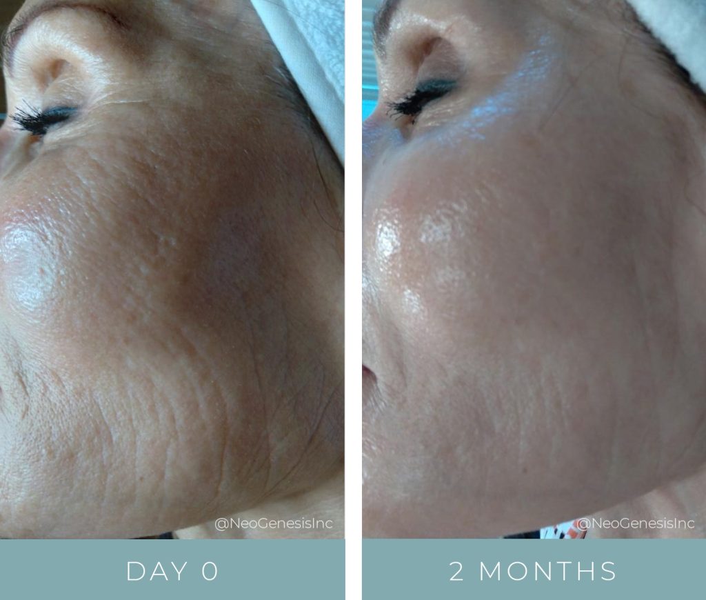 Before + After - Ageing Skin