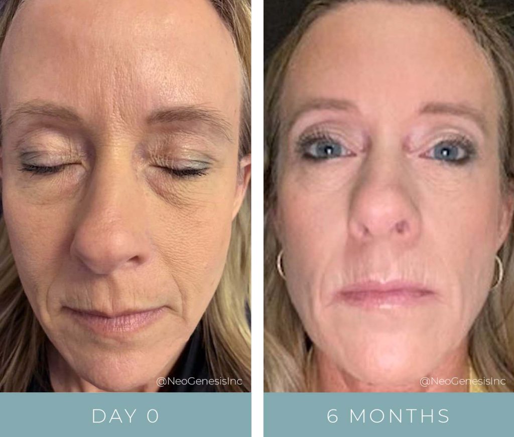 Before + After - Ageing Skin