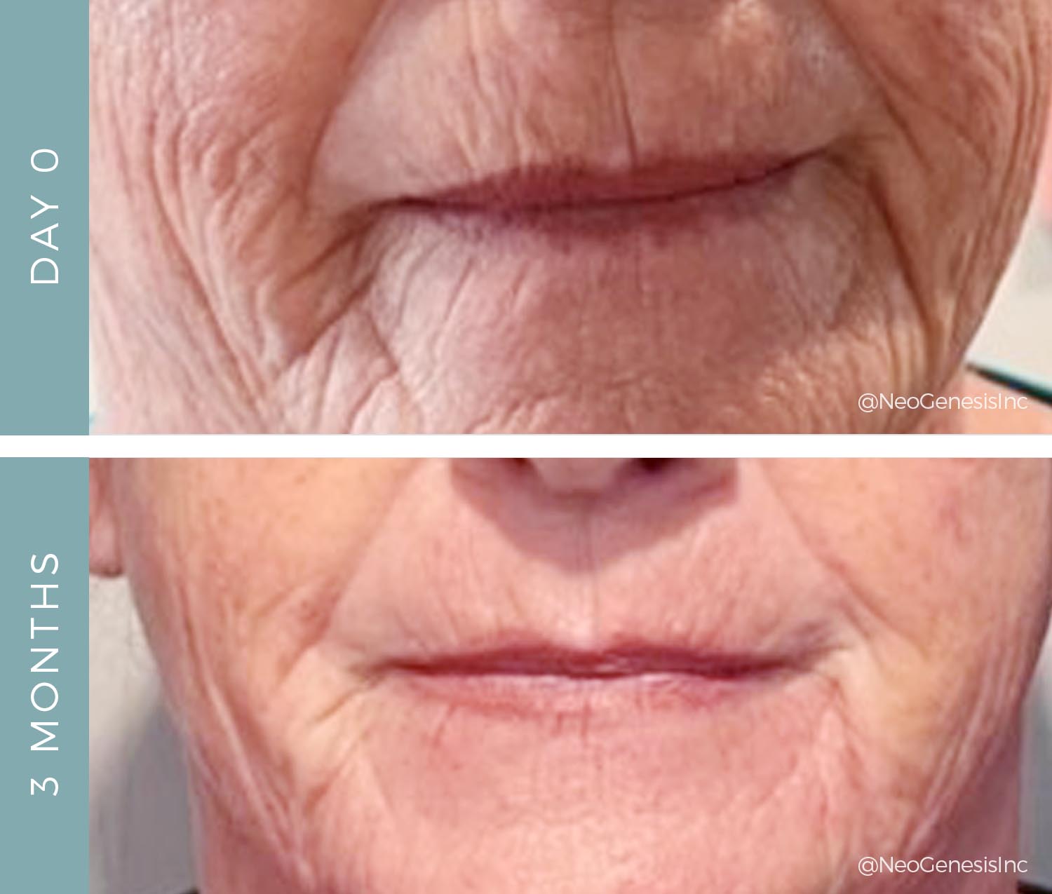 Before + After - Ageing Skin