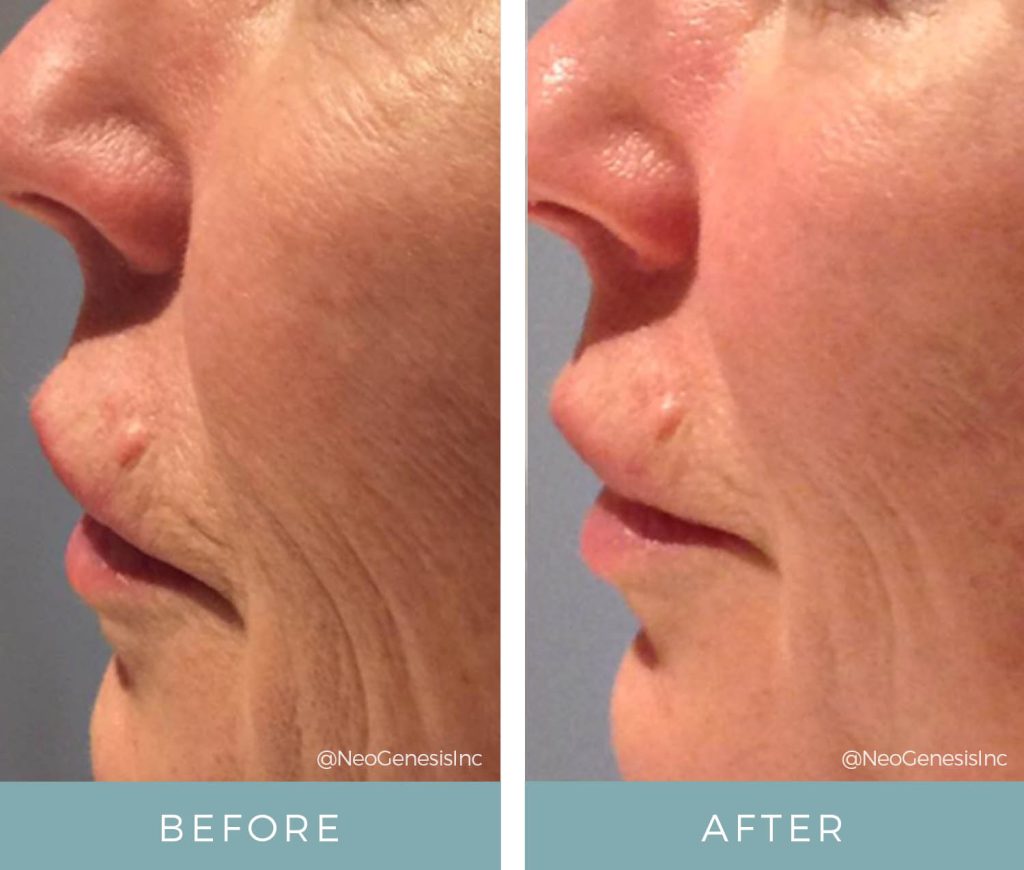 Before + After - Ageing Skin