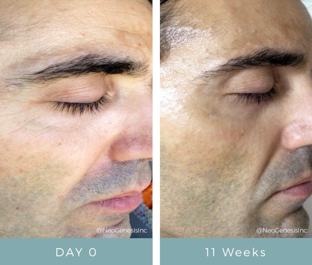 Before + After - Ageing Skin for Men