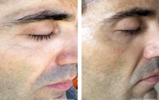 Before + After - Ageing Skin for Men