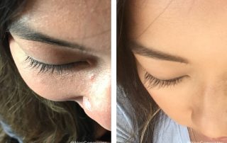 Before + After - Lash Loss