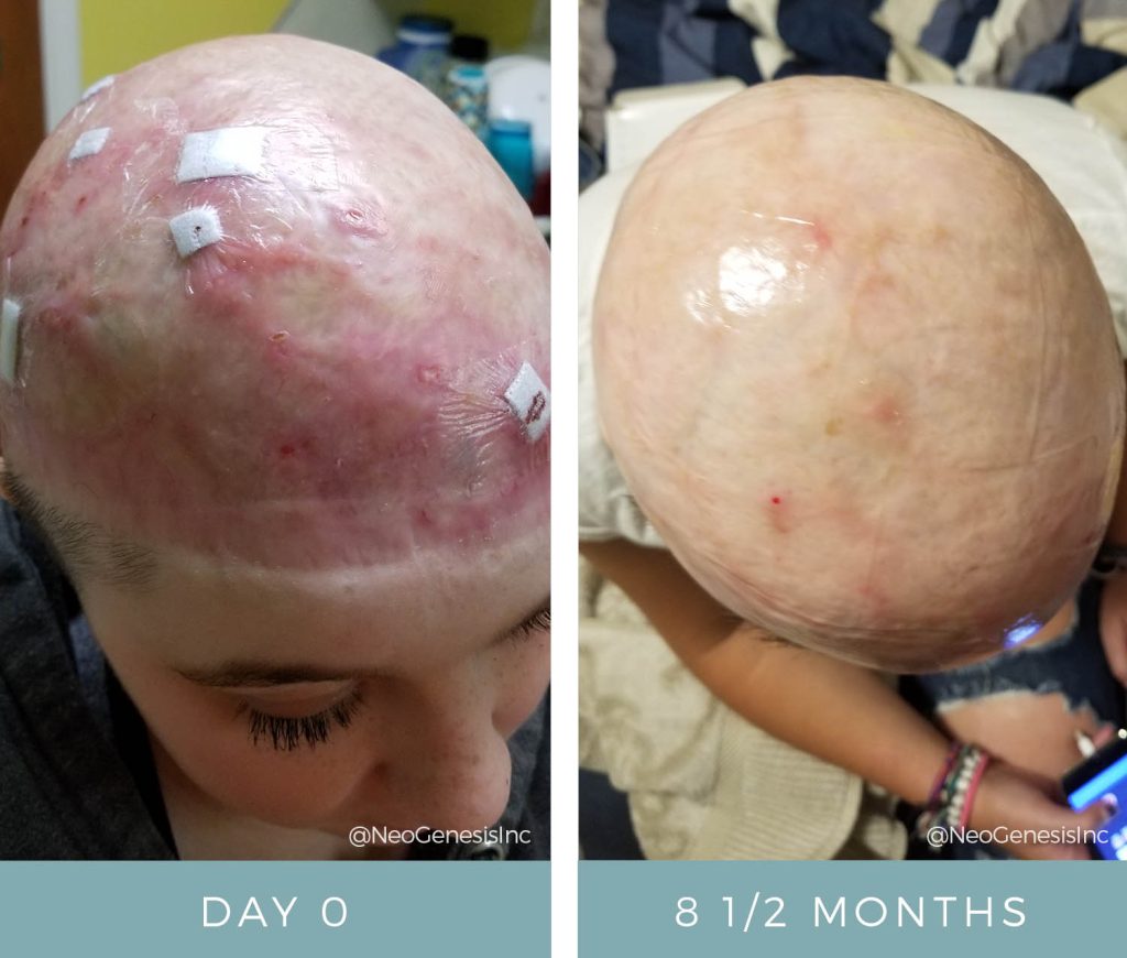 Before + After - Wound Care for a Scalp Injury