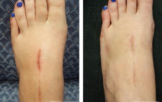 Before + After - Wound Care + Scarring