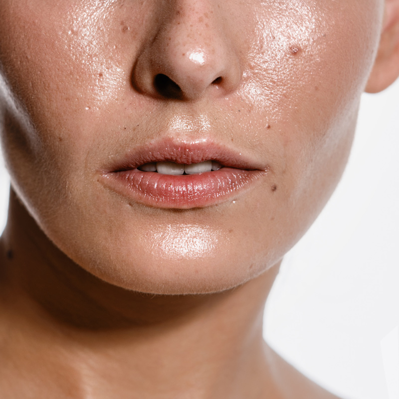 Oily Skin